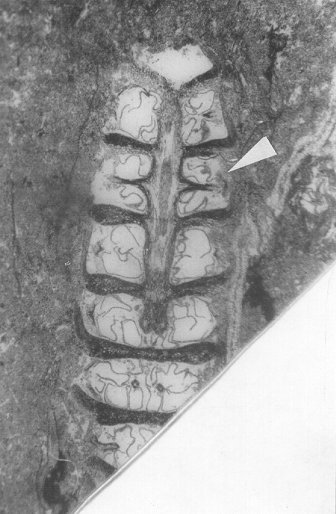 Calamostachys binneyana