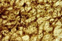 Schimmeldraden in Rhynie Chert