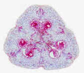 OvaryX-S.jpg (36643 bytes)