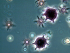Emericella_Asci_t.jpg (24217 bytes)