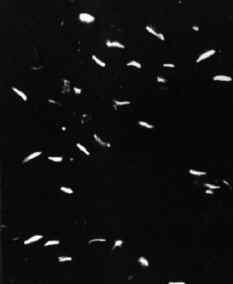 PryoLeptoCalloseFluor.jpg (28859 bytes)