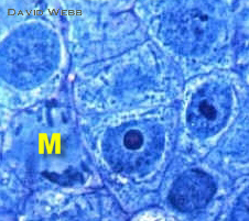 RAMZamVCloseMeriCellCropLab.jpg (46683 bytes)