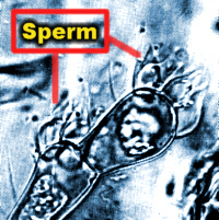 Sperm.jpg (57752 bytes)