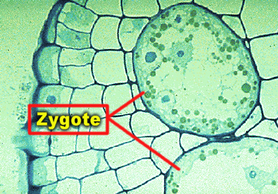 coleochaetezygoteLab.jpg (187692 bytes)