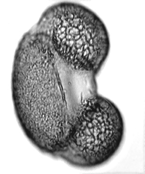 Pinus-Pollen-2-300.jpg (36122 bytes)