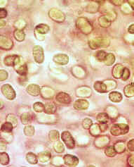 Anacystis.jpg (44283 bytes)