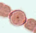 HeteroCloseLM.jpg (3077 bytes)