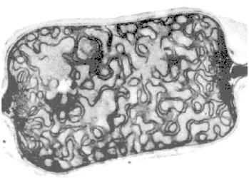 Heterocyst.jpg (60034 bytes)