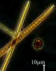 Planktothrix.jpg (31457 bytes)