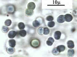 Synechococcus.jpg (42395 bytes)