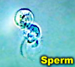 SpermRoyalFernLab.jpg (15281 bytes)