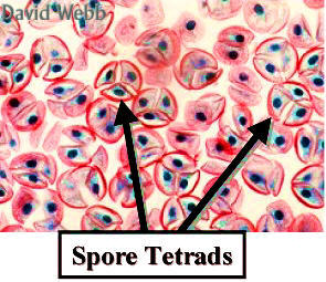 SporeTet240Lab.jpg (33417 bytes)