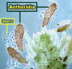 takakiaantheridiaspermLab.jpg (162824 bytes)