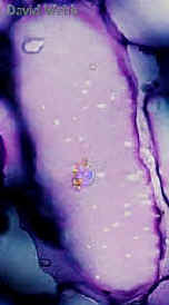 LeucoParenPits200.jpg (41185 bytes)