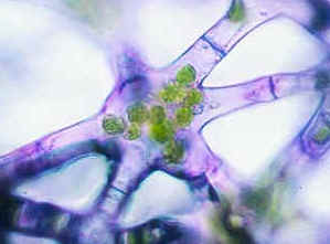 StellateParen400.jpg (107433 bytes)