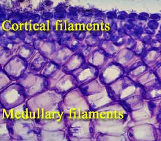 NewMomomerpicCortexMedLab.jpg (81443 bytes)