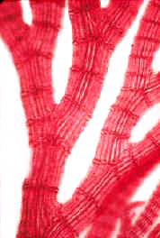 PolysiphoniaBodyBranch.jpg (31926 bytes)