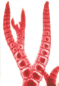 PolysiphoniaMicroTip240.jpg (22319 bytes)