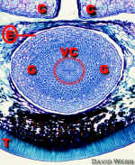 BeanSeedAxis400Lab.jpg (141284 bytes)