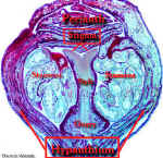 PerigynousBudLSHue400Lab.jpg (75524 bytes)