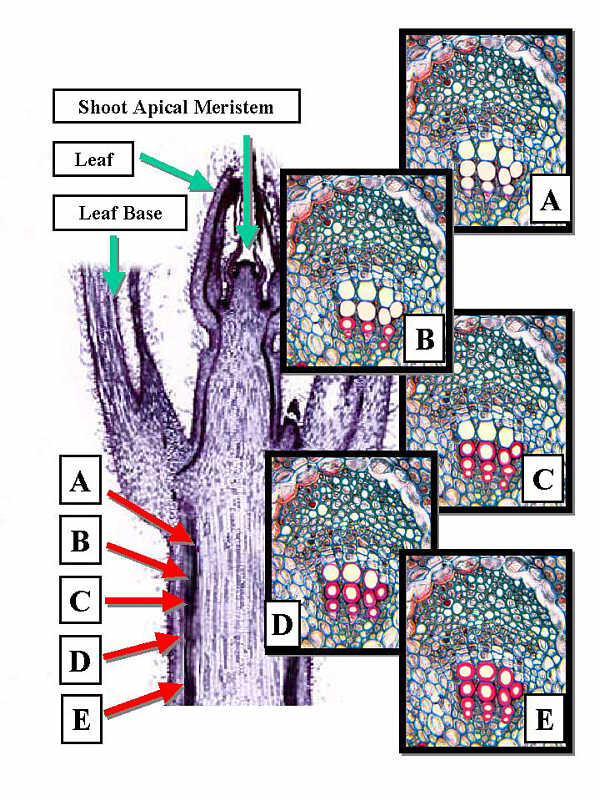 XylmDifferCollageLab600.jpg (115172 bytes)