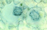 DruseParenCells160.jpg (5656 bytes)
