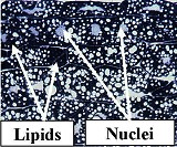 LipSudBlaklab160.jpg (16409 bytes)