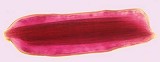 RaphVacuole160.jpg (2955 bytes)