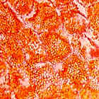 chromplst160.jpg (19899 bytes)